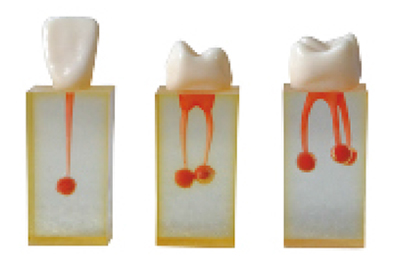 Dental Canal - TM-N3