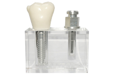Trans Implant Model - TM-T20
